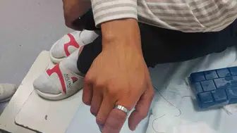 Bitlis'te parmağı moraran hastanın yardımına itfaiye yetişti