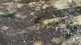 Parkta oturan adamı döner bıçağıyla yaraladı, polis kaçarken yakaladı