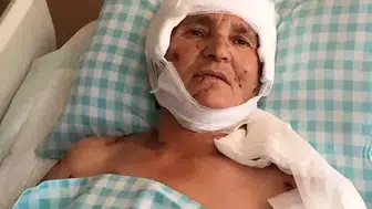 Köpek saldırısına uğrayan kadına mahkemeden emsal tazminat kararı