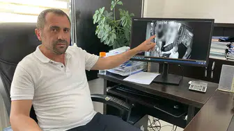 Sivas’ta engelli yolcu tartışması sosyal medyayı yanılttı