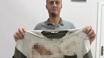 Gürültü uyarısı kanlı bitti: Akrabalarının sopalı saldırısına uğrayan genç dehşeti yaşadı