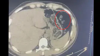 Diyarbakır'da mide bulandıran narkotik operasyonu: 780 gram metamfetaminle yakalandılar