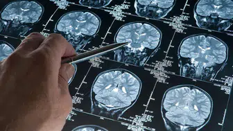 Hafıza kaybına karşı uykuda gizli savunma: Beyin dalgaları Alzheimer'ı durdurabilir