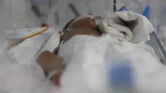Bin 300 gramlık mucize: Defne Devlet Hastanesi'nde hayata tutunan ikizlerin hikayesi