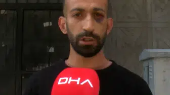 Fatura kavgasıyla başlayan dehşet: Ünlü oyuncunun kiracısı sokak ortasında darbedildi