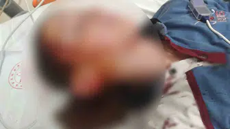 Yüzündeki kalıcı iz 1.2 milyon liraya mal oldu: Köpek sahiplerine emsal karar