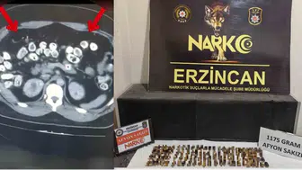 Erzincan'da röntgen cihazı zehir tacirlerini ele verdi: Kapsüller mideden çıktı
