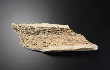 Bilim insanlarından müjde: Sağlıklı kemikler için yeni bir yol bulunmuş olabilir