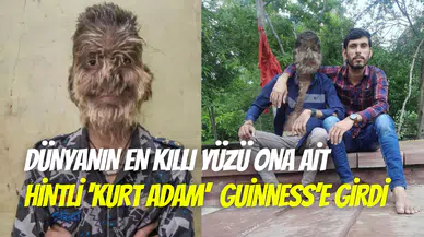 Dünyanın en kıllı yüzü ona ait: Lalit Patidar Guinness Rekorlar Kitabı’na girdi