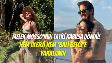 Melek Mosso’nun Bali tatili kabusa döndü: Hem alerji hem ‘Bali Belly’