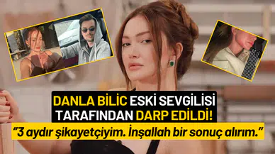 Danla Bilic Eski Sevgilisi Berk Çetin Tarafından Darp Edildi: “Aylarca Sustum, Artık Dayanamıyorum”