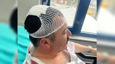 Kahramanmaraş'ta belediyede şekerlikli saldırı: YRP’li yönetici tutuklandı
