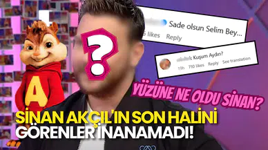 Estetik yaptı, Kuşum Aydın'a Döndü: Sinan Akçıl'ın Son Hali Sosyal Medyayı Salladı!