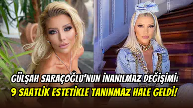 Gülşah Saraçoğlu estetik yapmadı, yüz nakli geçirdi: “Doğal olan sadece saçlarım ve dişlerim”
