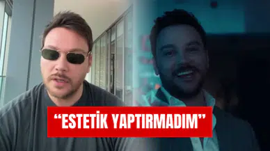 Kuşum Aydın'a Dönen Sinan Akçıl'dan Estetik Açıklaması!