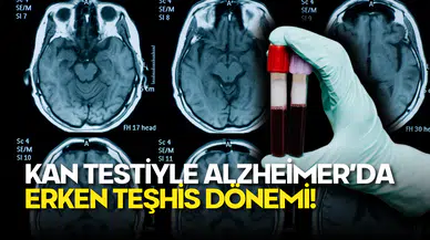 Kan Testiyle Alzheimer’da Erken Teşhis Dönemi