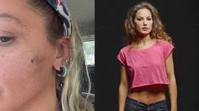 Oyuncu Yıldız Asyalı’dan şoke eden iddia: “Eşim tarafından darp edildim”