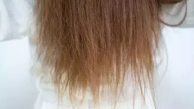 Yanmış ve yıpranmış saçları canlandıracak en etkili 3 yöntem