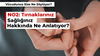 Tırnaklarınız Sağlığınız Hakkında Ne Anlatıyor? Tırnaklarda Beyazlık!