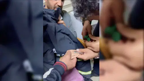 Oyun oynarken kabusu yaşadı: Minik Berfin'in parmağı boruya hapsoldu