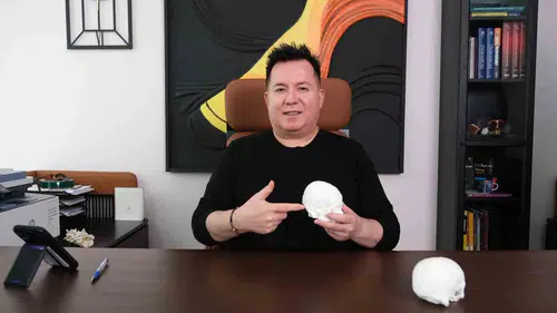Geçmeyen baş ağrılarına dikkat Beyin tümöründe erken teşhis hayat kurtarıyor