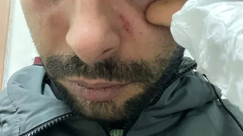 Hatay’da acil serviste doktordan hastaya yumruklu saldırı