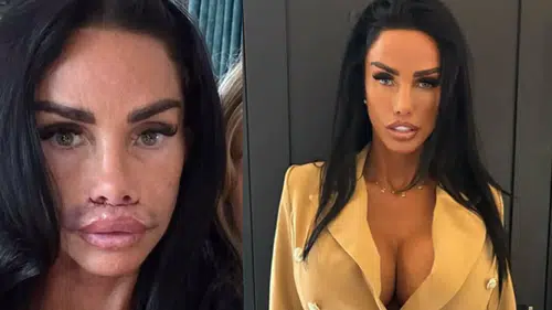 Katie Price geçirdiği operasyon sonrası son halini paylaştı