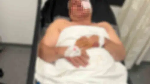 Aydın’da şüpheli kaza Kardeşinin kendisine çarptığını iddia etti