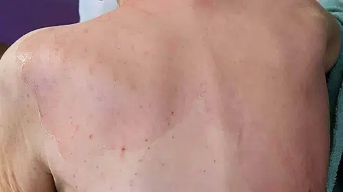 Huzurevinde ihmal sonucu ölen kadın davasında şaşırtan karar