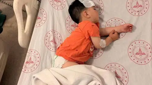 Halfeti'de küçük çocuğa sokak köpeği saldırdı