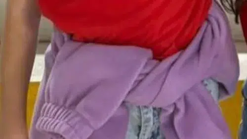 Diş tedavisinde genel anestezi sonrası acı veda