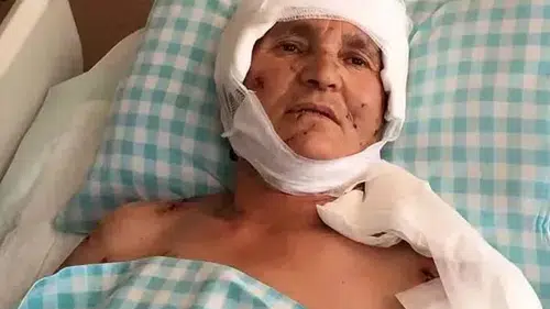 Köpek saldırısına uğrayan kadına mahkemeden emsal tazminat kararı