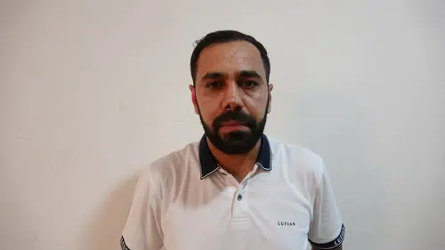 Estetik ameliyat sonrası yüzünde iz kalan hasta hastaneye dava açtı