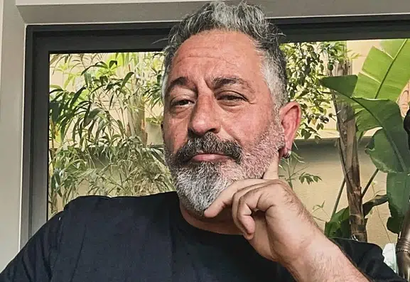 Çanakkale'de anjiyo olan Cem Yılmaz katıldığı davette bastonla görüntülendi