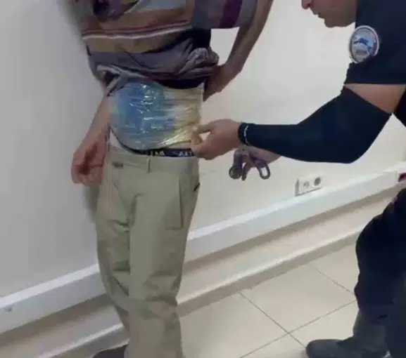 Hatay polisine yakalanan firarinin vücuduna gizlediği esrarlar şaşkına çevirdi