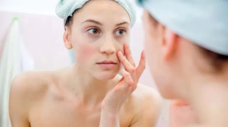 Cilt sağlığı için uzak durulması gereken 5 temel yiyecek