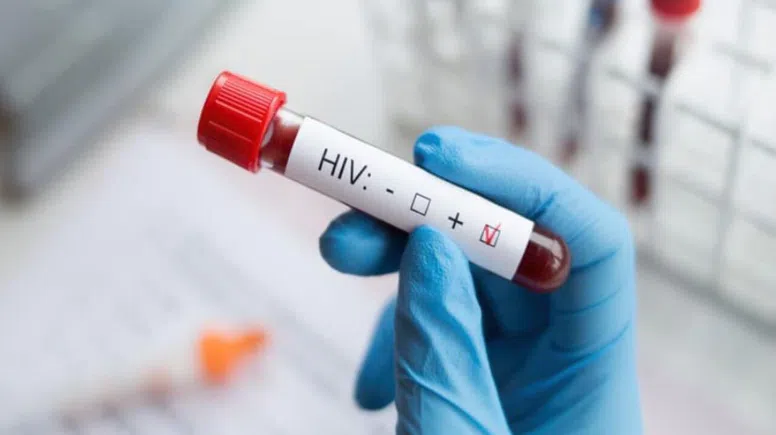 HIV durumunu gizleyerek evlendi: Mahkemeden hapis cezası