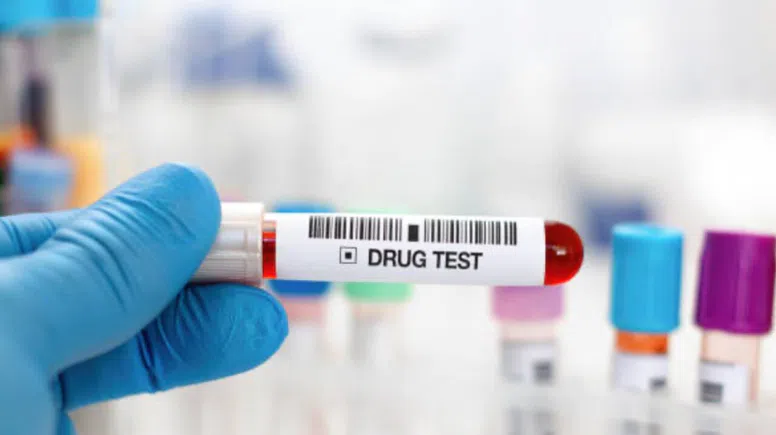 Şirketlerden radikal karar: İşe alımda uyuşturucu testi zorunlu