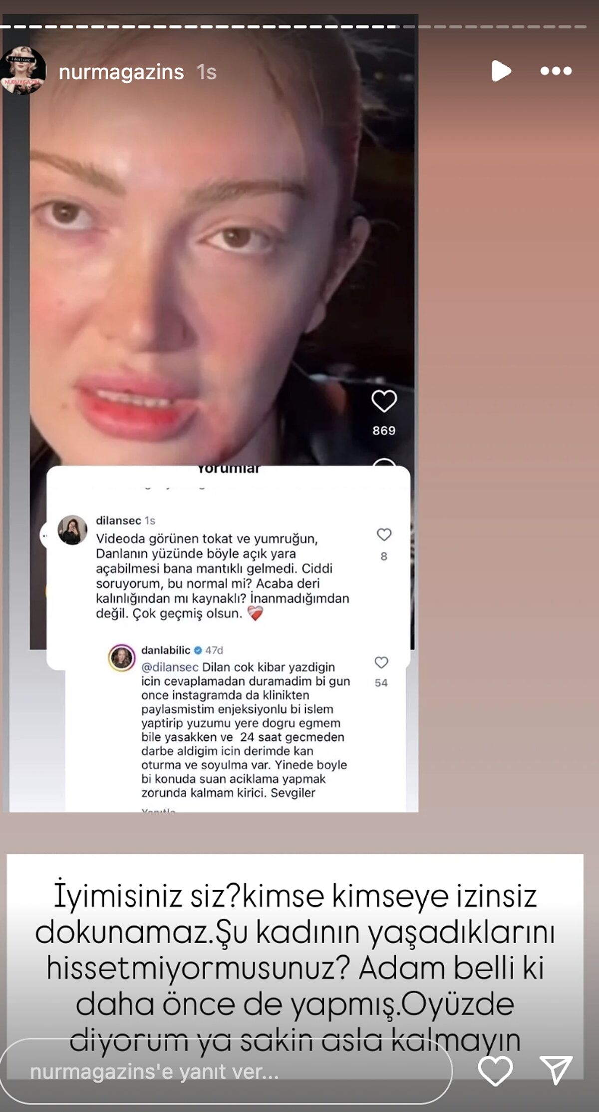 Danla Bilic, İzini Sorgulayan Kullanıcıya Yanıt Verdiaçıklama Yapmak Zorunda Kalmam Kırıcı