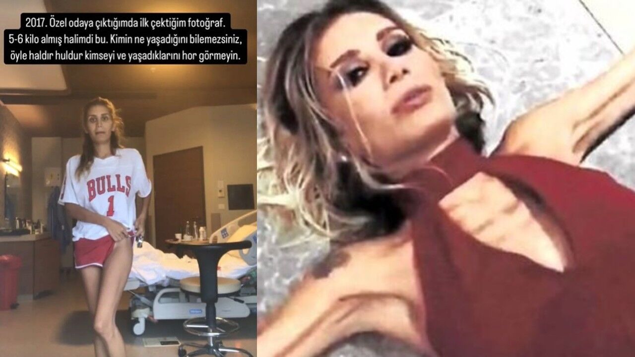 Nihal Candan’ın Trajik Kaybı Anoreksiyayı Gündeme (1)