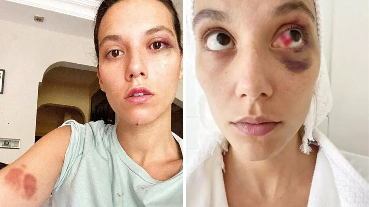 Tepkiler Boşa Gitmedi Ozan Güven 7 Kocalı Hürmüz Müzikali'nden Ayrıldı!