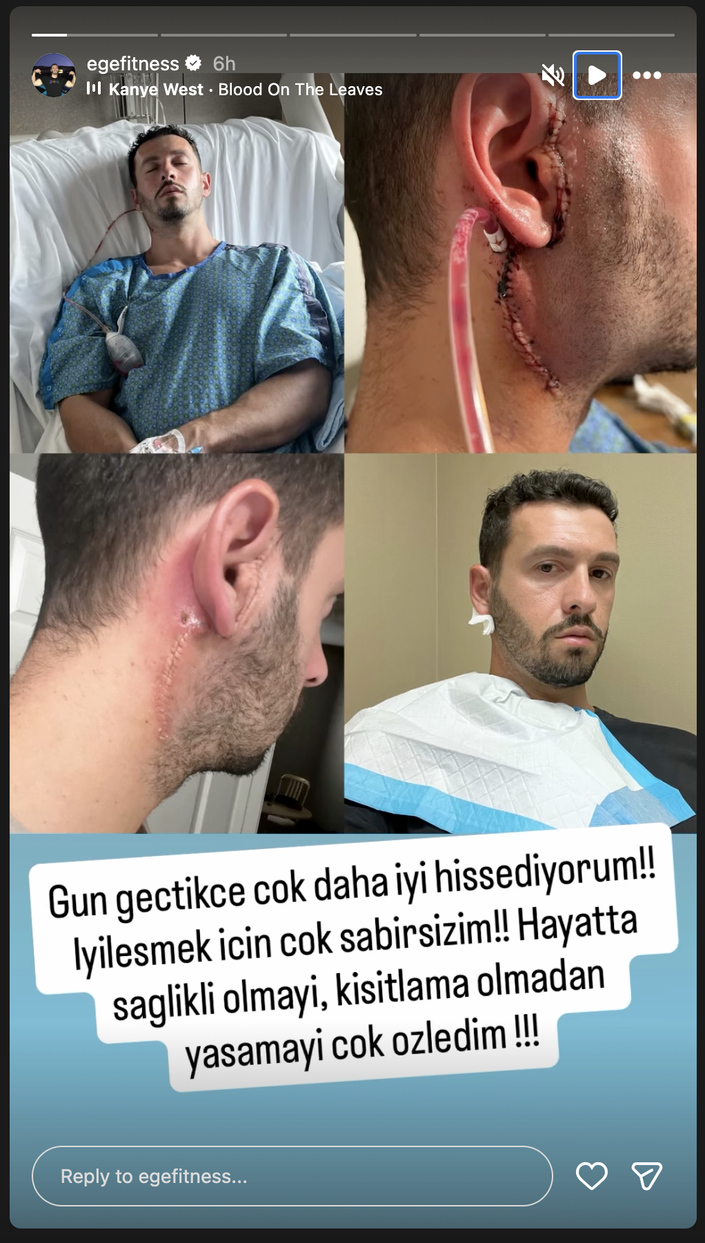 Vücudunda Tümör Bulunan Egefitness’tan Flaş Açıklama! 1