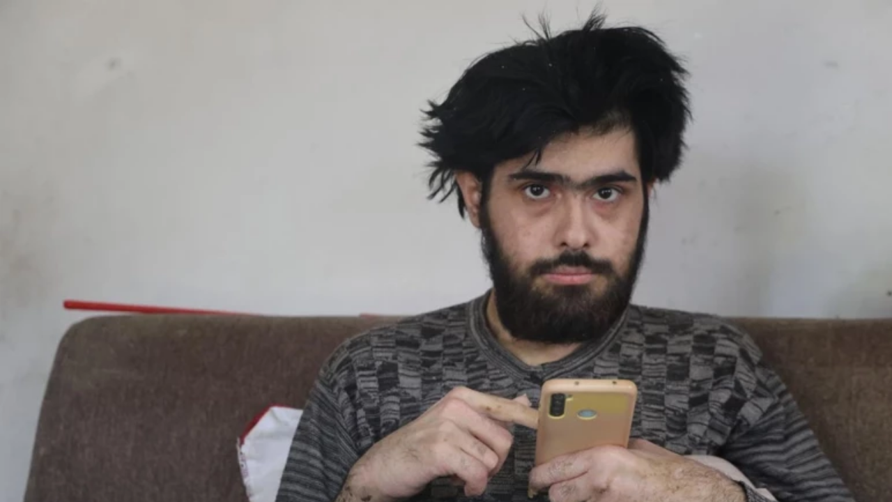 3 Yıldır Duş Almayan Gence Depresyon Ve Anksiyete Tanısı Kondu! (4)