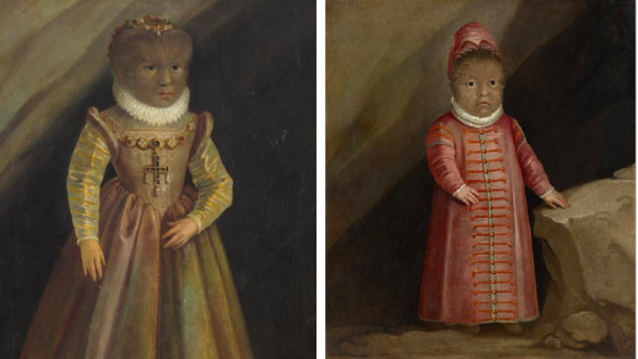 Güzel Ve Çirkin Masalına Ilham Olan Adam Petrus Gonsalvus! (1)