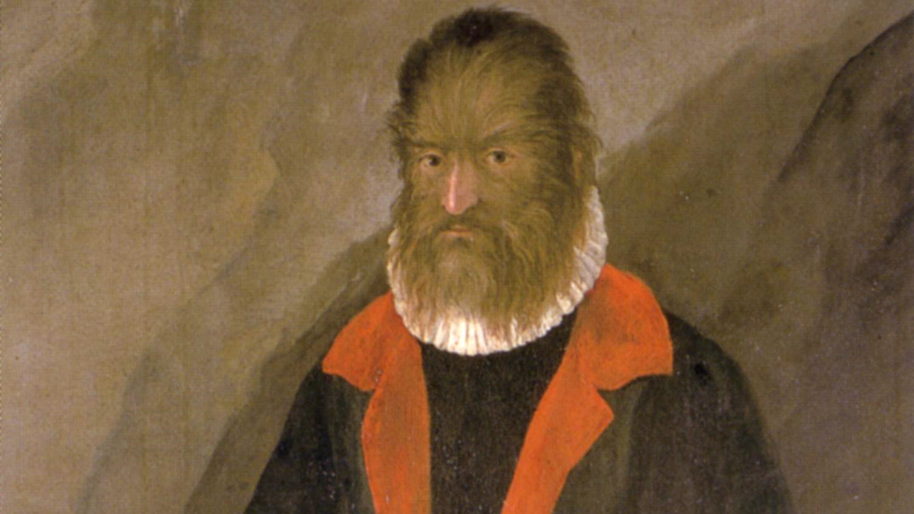 Güzel Ve Çirkin Masalına Ilham Olan Adam Petrus Gonsalvus!