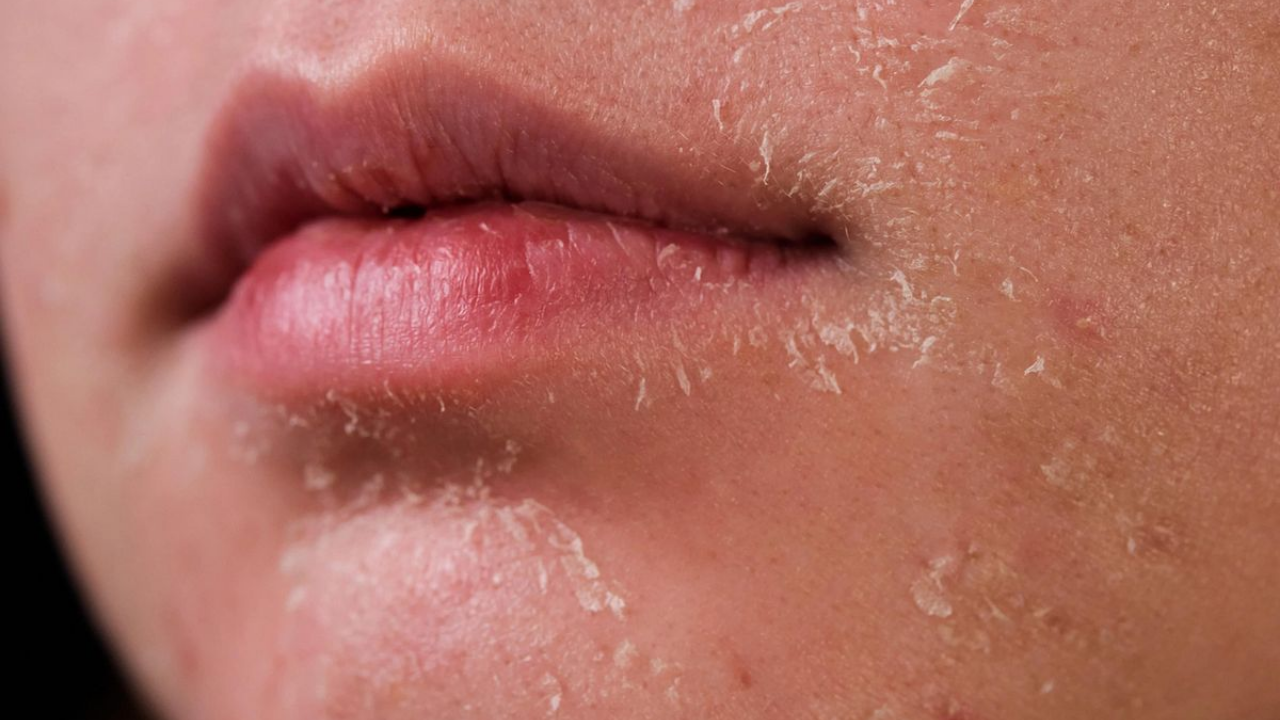 Kuru Ciltler Için Cilt Bakımı Nasıl Olmalı