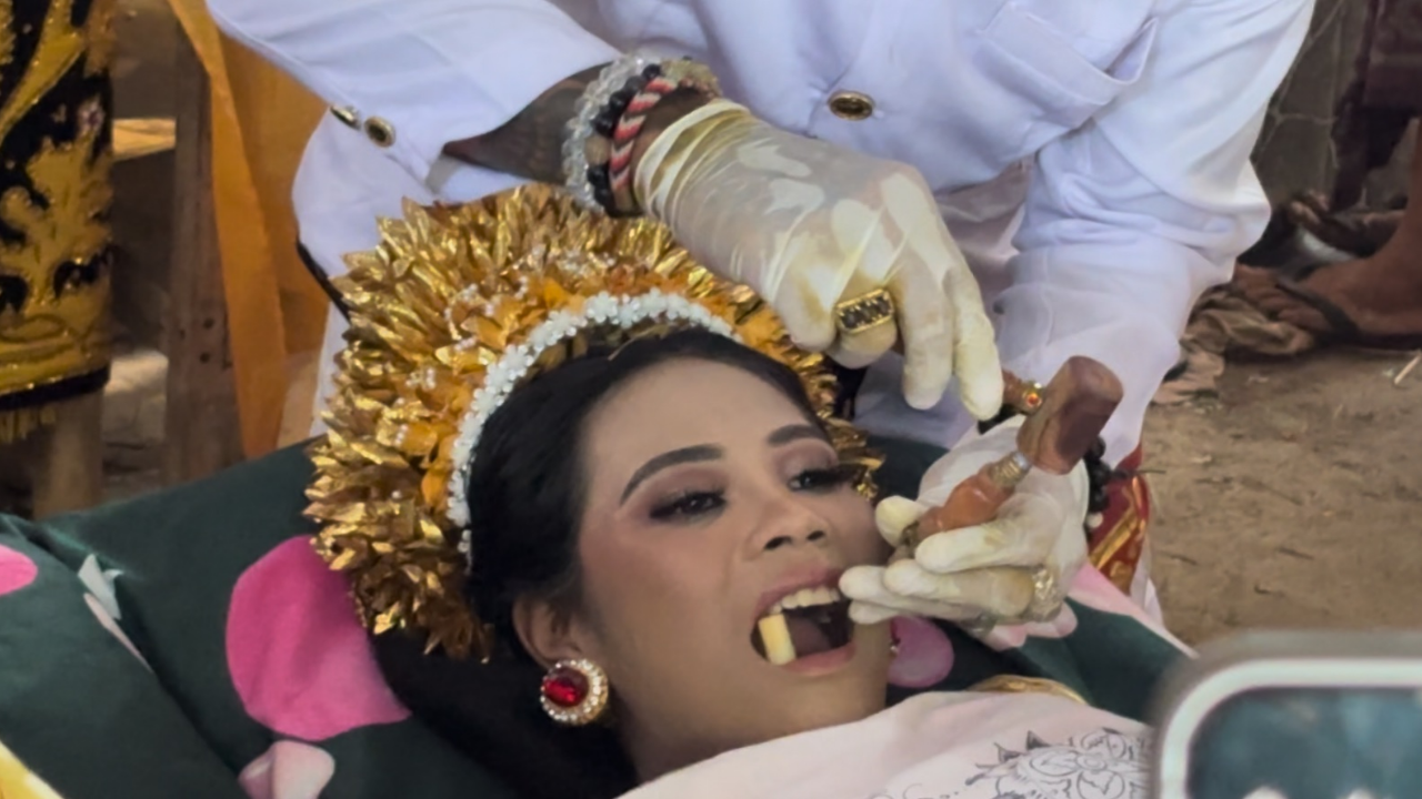 Bali’de Ilginç Ritüel Dişlerini Törpülüyorlar