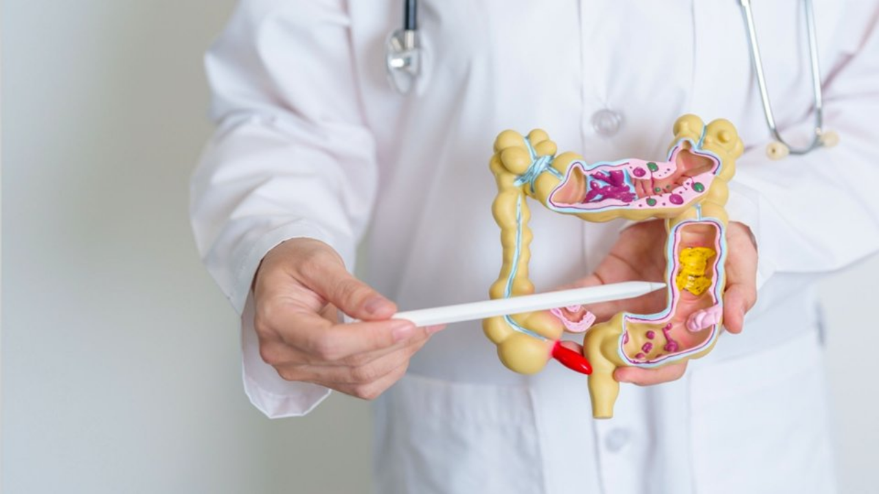 Murat Cemcir'in Hastalığı Divertikül Kanaması Nedir (2)