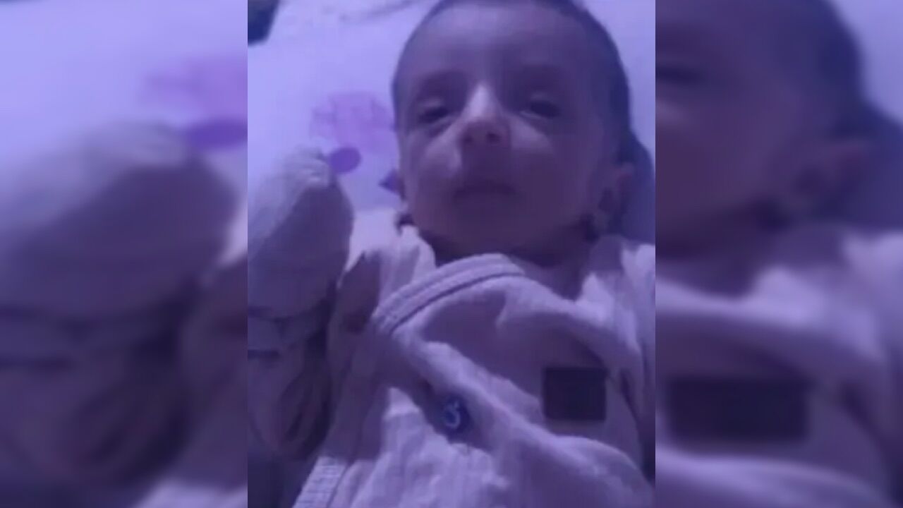 Açlıktan Ölen Bebek 3