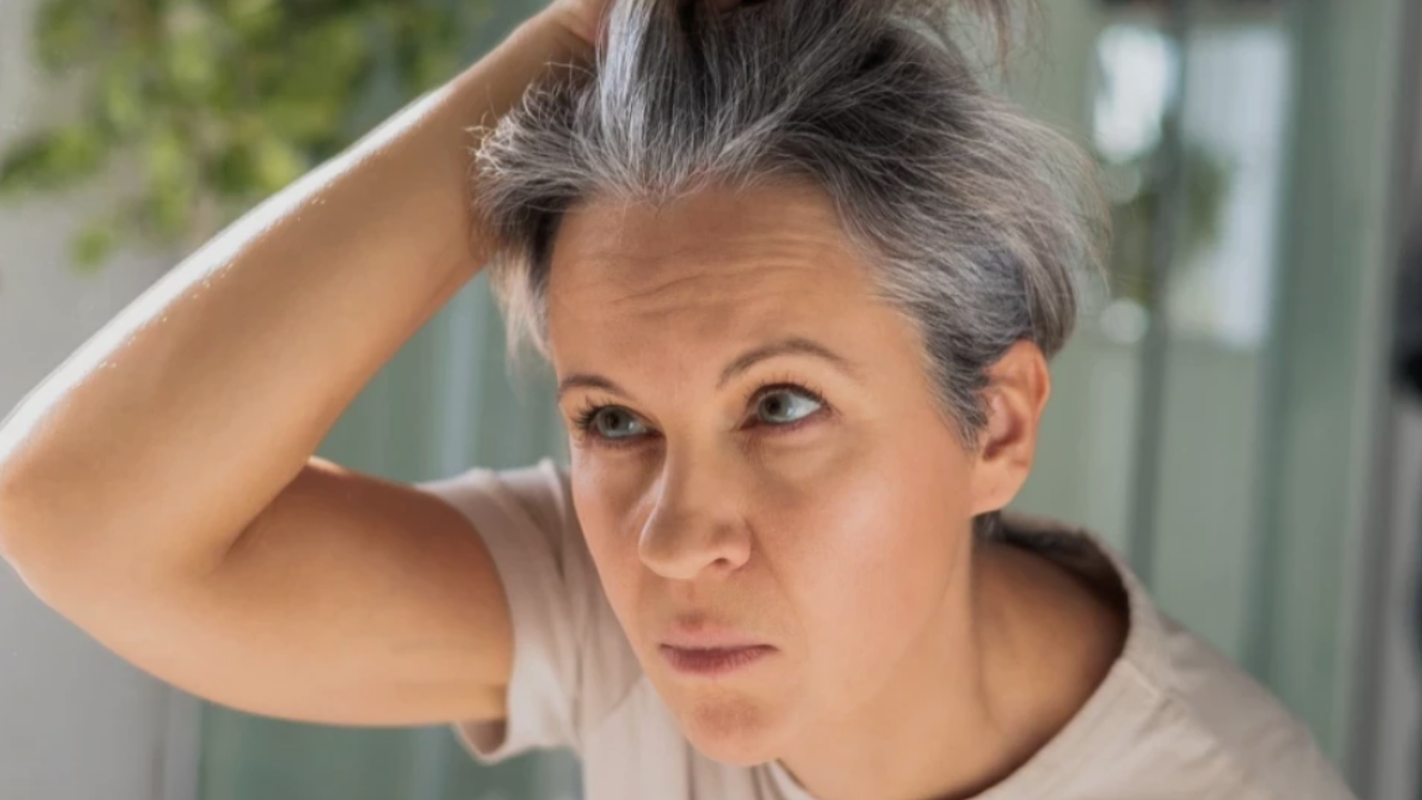 Saç Beyazlaması (2)